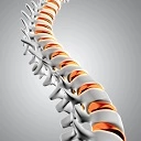 spine disease